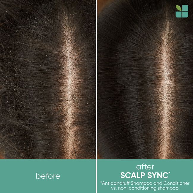 Scalp Sync Antidandruff Shampoo